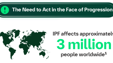 The Need to Act in the Face of Progression